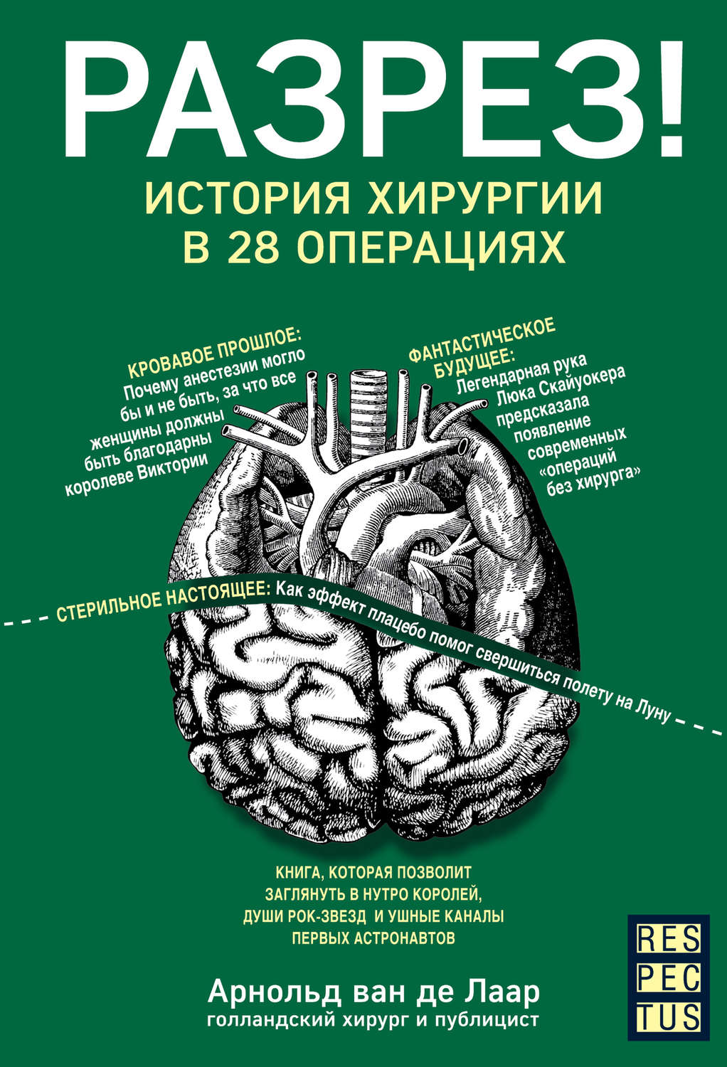 Истории из жизни Разрез! История хирургии в 28 операциях(Арнольд Лаар) 